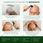 Neo Hair Lotion Paradise – Herbal Hair Regrowth Solution